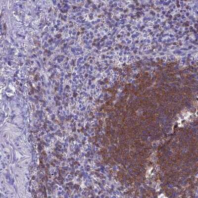 Immunohistochemistry-Paraffin: Septin-1 Antibody [NBP1-84251]