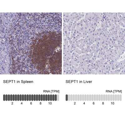 Immunohistochemistry-Paraffin: Septin-1 Antibody [NBP1-84251]