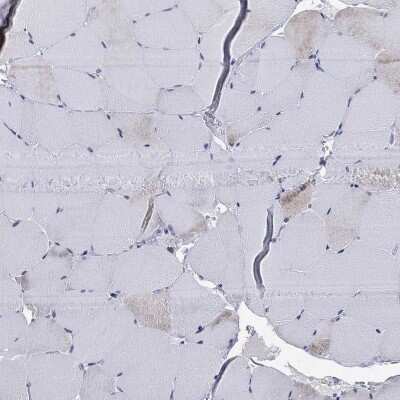 Immunohistochemistry-Paraffin: Septin-1 Antibody [NBP3-17043]
