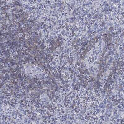 Immunohistochemistry-Paraffin: Septin-1 Antibody [NBP3-17043]