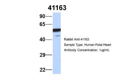 Western Blot: Septin-11 Antibody [NBP1-58144]