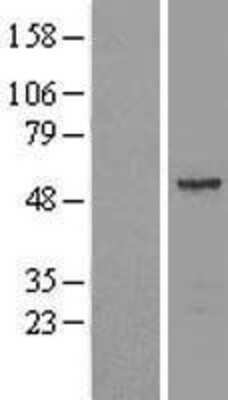 Western Blot: Septin-11 Overexpression Lysate [NBL1-07152]