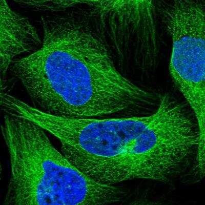 Immunocytochemistry/ Immunofluorescence: Septin-12 Antibody [NBP1-91640]