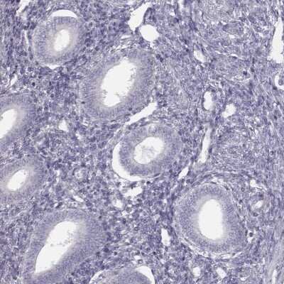 Immunohistochemistry-Paraffin: Septin-14 Antibody [NBP2-57892]