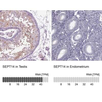Immunohistochemistry-Paraffin: Septin-14 Antibody [NBP2-57892]