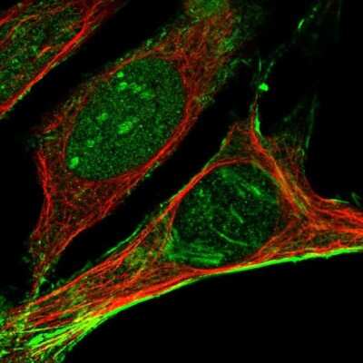 Immunocytochemistry/ Immunofluorescence: Septin-2 Antibody [NBP1-85212]