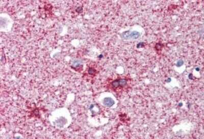 Immunohistochemistry-Paraffin: Septin-2 Antibody [NBP1-06076]