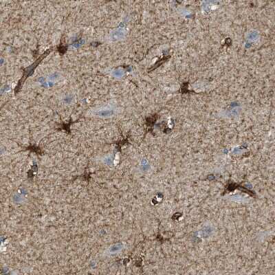 Immunohistochemistry-Paraffin: Septin-2 Antibody [NBP1-85212]