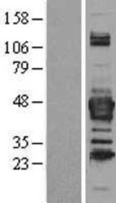 Western Blot: Septin-3 Overexpression Lysate [NBL1-07141]