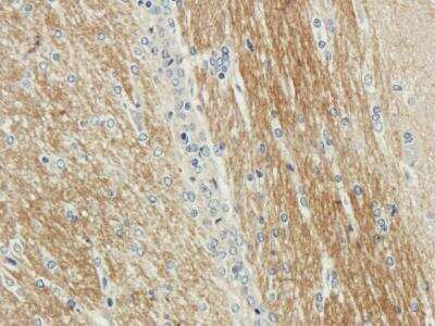 Immunohistochemistry: Septin-5 Antibody (SP18) - Azide and BSA Free [NBP2-81058]