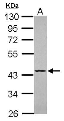 Western Blot: Septin-5 Antibody [NBP2-15115]
