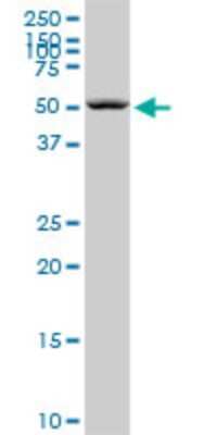 Western Blot: Septin-6 Antibody (1D6) [H00023157-M01]