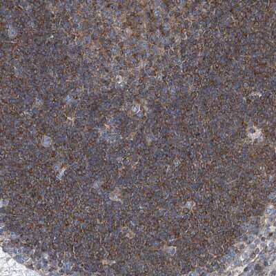 Immunohistochemistry-Paraffin: Septin-7 Antibody [NBP1-85731]