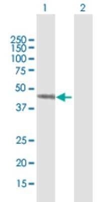 Western Blot: Septin-7 Antibody [H00000989-B01P]