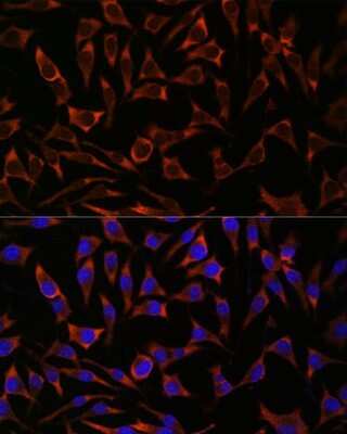 Immunocytochemistry/ Immunofluorescence: Septin-8 Antibody - Azide and BSA Free [NBP2-93880]