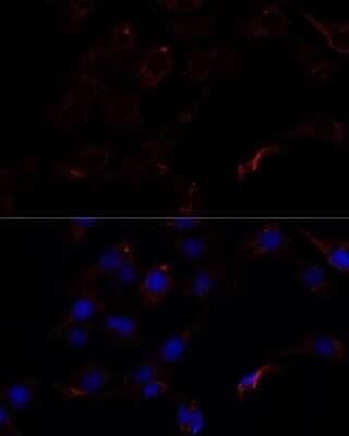 Immunocytochemistry/ Immunofluorescence: Septin-8 Antibody - Azide and BSA Free [NBP2-93880]