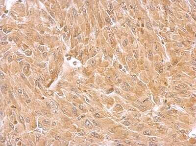 Immunohistochemistry-Paraffin: Septin-8 Antibody [NBP2-15116]