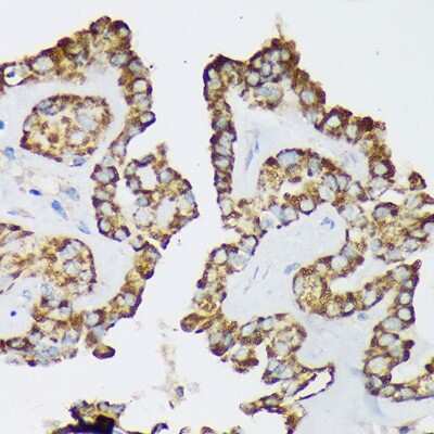 Immunohistochemistry-Paraffin: Septin-8 Antibody - Azide and BSA Free [NBP2-93880]