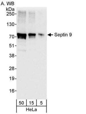 Western Blot: Septin-9 Antibody [NBP1-28764]