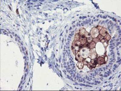 Immunohistochemistry: Serine Dehydratase Antibody (OTI3D3) - Azide and BSA Free [NBP2-74074]