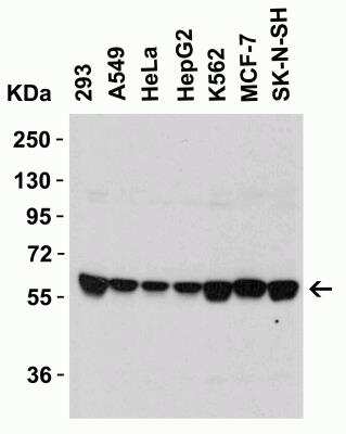 Western Blot: Serine Palmitoyltransferase 2 AntibodyBSA Free [NBP1-76573]