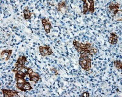 Immunohistochemistry-Paraffin: Serine racemase Antibody (OTI2E3) [NBP2-02332]