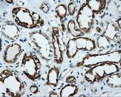 Immunohistochemistry-Paraffin: Serine racemase Antibody (OTI2E3) [NBP2-02332]