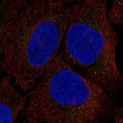 Immunocytochemistry/ Immunofluorescence: Serine racemase Antibody [NBP2-58903]