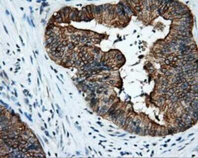 Immunohistochemistry: Serine racemase Antibody (OTI2E3) - Azide and BSA Free [NBP2-74083]