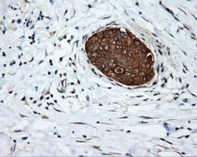 Immunohistochemistry: Serine racemase Antibody (OTI2E3) - Azide and BSA Free [NBP2-74083]