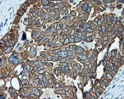 Immunohistochemistry: Serine racemase Antibody (OTI2E3) - Azide and BSA Free [NBP2-74083]