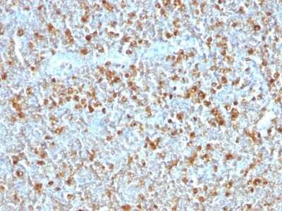 Immunohistochemistry-Paraffin: Serpin A1/alpha 1-Antitrypsin Antibody (AAT/1379) [NBP2-53302]