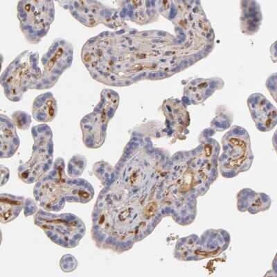 Immunohistochemistry-Paraffin: Serpin A1/alpha 1-Antitrypsin Antibody [NBP1-90308]