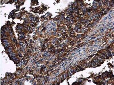 Immunohistochemistry-Paraffin: Serpin A1/alpha 1-Antitrypsin Antibody [NBP2-15349]