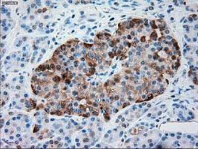 Immunohistochemistry: Serpin A1/alpha 1-Antitrypsin Antibody (OTI9A1) - Azide and BSA Free [NBP2-74095]