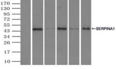 Immunoprecipitation: Serpin A1/alpha 1-Antitrypsin Antibody (OTI9A1) - Azide and BSA Free [NBP2-74095]