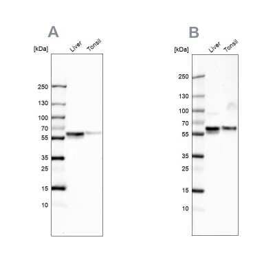 Western Blot: Serpin A1/alpha 1-Antitrypsin Antibody [NBP1-90308]