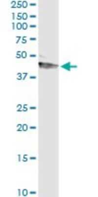 Immunoprecipitation: Serpin A12 Antibody (3B3) [H00145264-M01]
