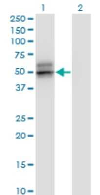 Western Blot: Serpin A12 Antibody (3B3) [H00145264-M01]