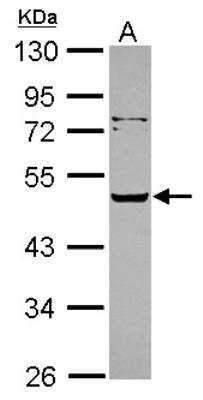 Western Blot: Serpin A12 Antibody [NBP2-15118]