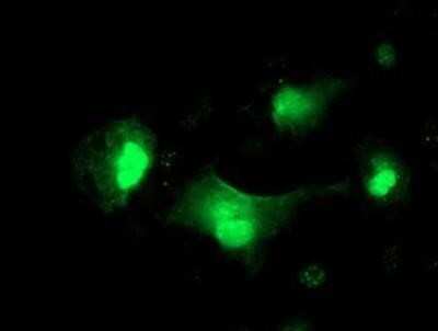 Immunocytochemistry/ Immunofluorescence: Serpin A5/Protein C Inhibitor Antibody (OTI2D10) - Azide and BSA Free [NBP2-74101]