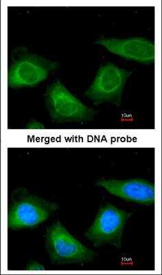Immunocytochemistry/ Immunofluorescence: Serpin A7/TBG Antibody [NBP1-32963]