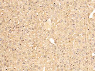 Immunohistochemistry-Paraffin: Serpin A7/TBG Antibody [NBP2-98256]
