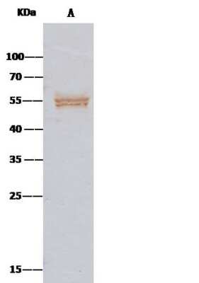 Immunoprecipitation: Serpin A8/Angiotensinogen Antibody (1) [NBP2-89736]