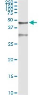 Immunoprecipitation: Serpin B3/SCCA1 Antibody (2F5) [H00006317-M01]
