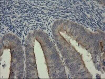 Immunohistochemistry: Serpin B3/SCCA1 Antibody (OTI3C2) - Azide and BSA Free [NBP2-74108]