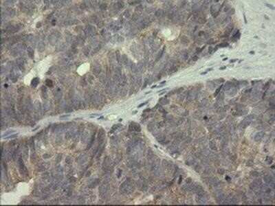 Immunohistochemistry-Paraffin: Serpin B3/SCCA1 Antibody (OTI3C2) [NBP2-03483]