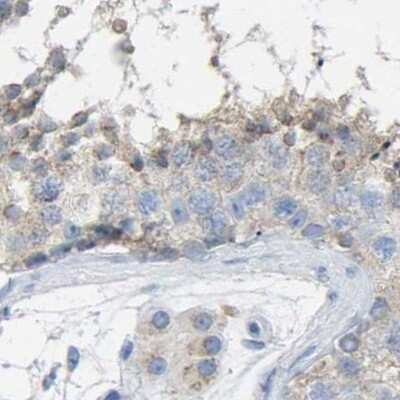 Immunohistochemistry-Paraffin: Serpin B5/Maspin Antibody [NBP1-87780]