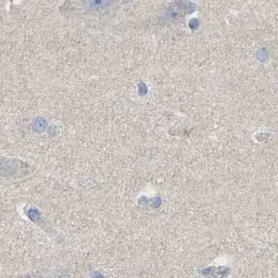 Immunohistochemistry-Paraffin: Serpin B5/Maspin Antibody [NBP1-87780]