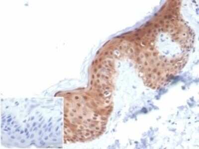 Immunohistochemistry-Paraffin: Serpin B5/Maspin Antibody (SERPINB5/4972) [NBP3-13732]